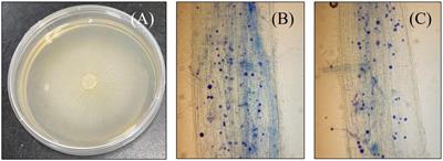 Tandem application of endophytic fungus Serendipita indica and phosphorus synergistically recuperate arsenic induced stress in rice